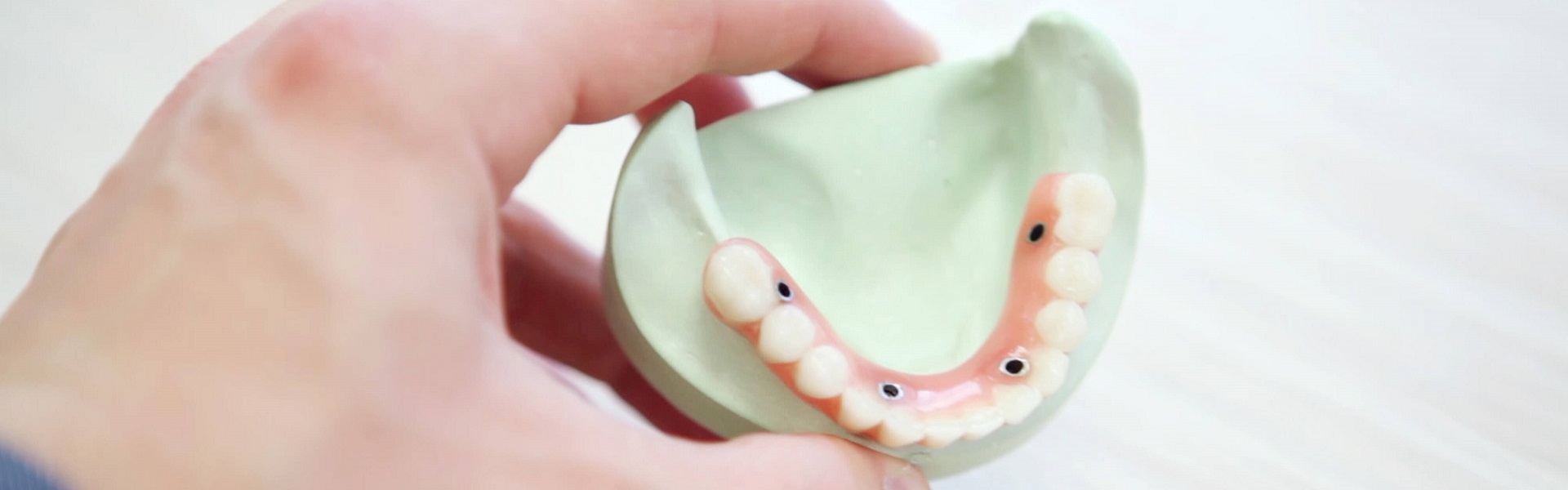 Iznajmljivanje kombija | Zubna tehnika